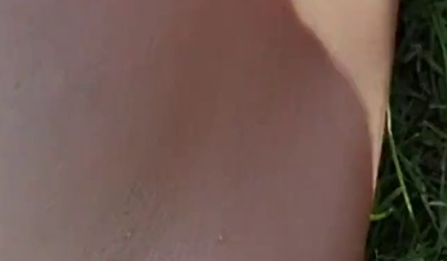 In die Achsel gewixxt