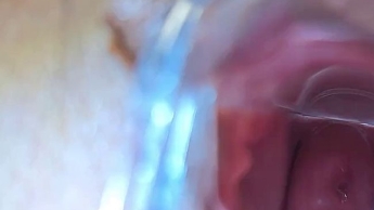 2 Clips // Nahaufnahme Spekulum vom ,,Speculum-Live-Treffen“