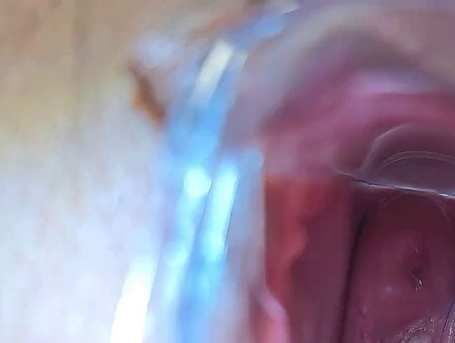 2 Clips // Nahaufnahme Spekulum vom ,,Speculum-Live-Treffen“