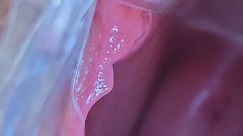 Eine gutbeleuchtete Fotze von Innen – Speculum und Tachenlampe