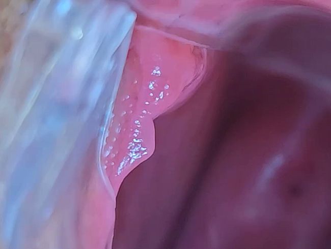 Eine gutbeleuchtete Fotze von Innen – Speculum und Tachenlampe